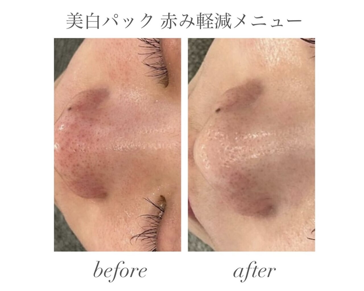 施術室の雰囲気